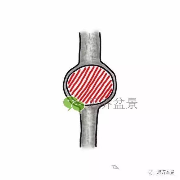 盆景截口怎么处理的技术