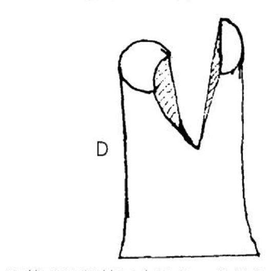 图解 以下几个因素影响着盆景的成活率