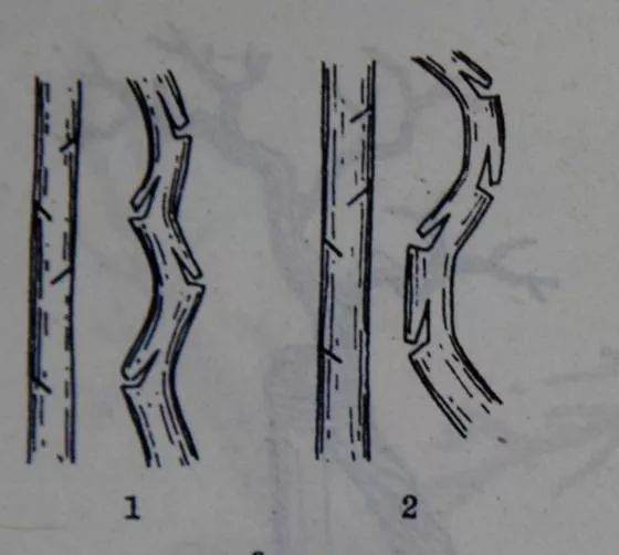 图解 盆景主干怎么拿弯的5个方法