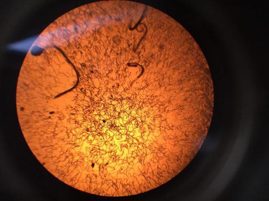 上海市南汇区广州管圆线虫病自然疫源地调查