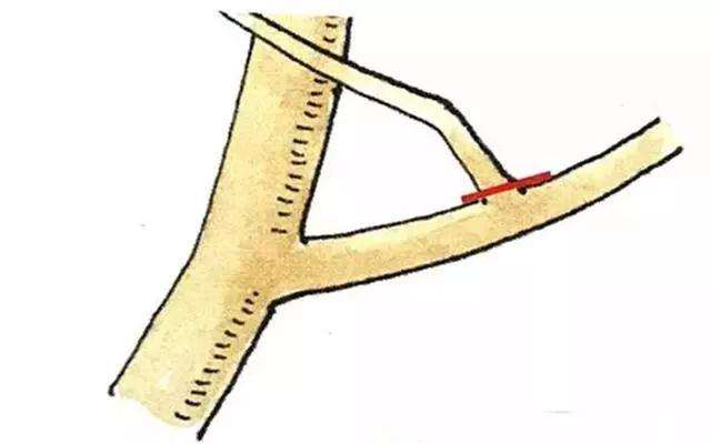 微型盆景怎么修剪造型的方法