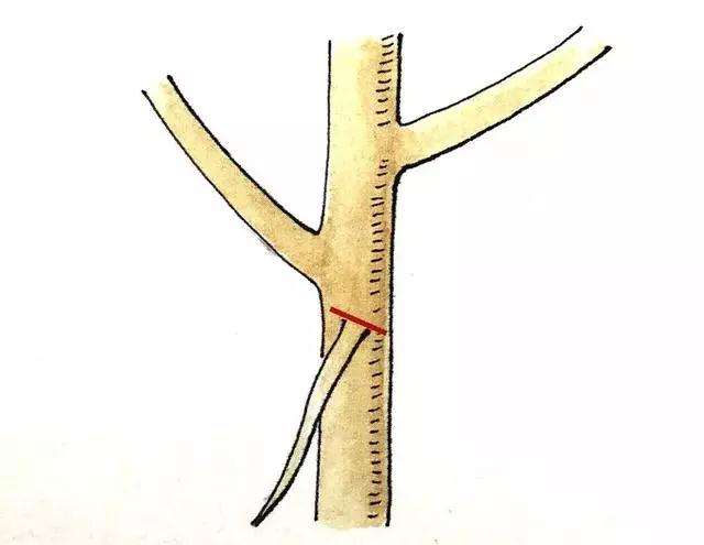 盆景定枝修剪忌枝的种类有哪些