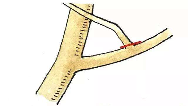 盆景定枝修剪忌枝的种类有哪些
