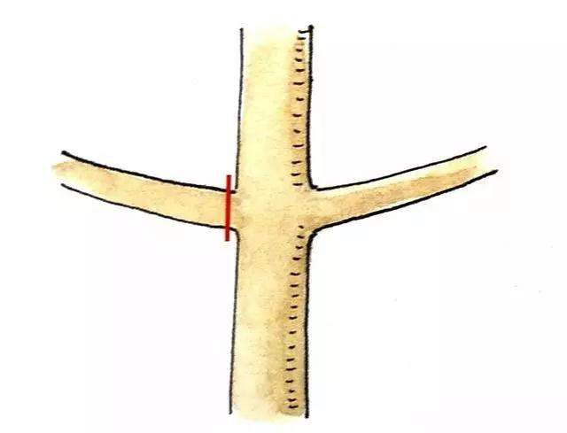盆景定枝修剪忌枝的种类有哪些