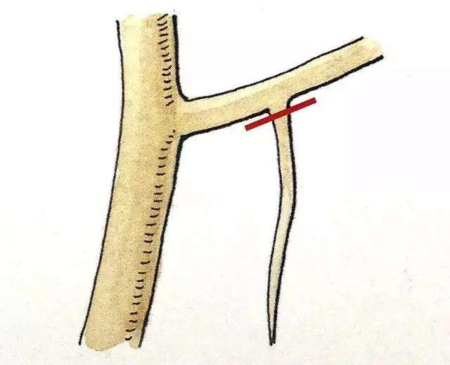 盆景定枝修剪忌枝的种类有哪些