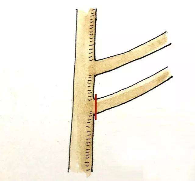 盆景定枝修剪忌枝的种类有哪些