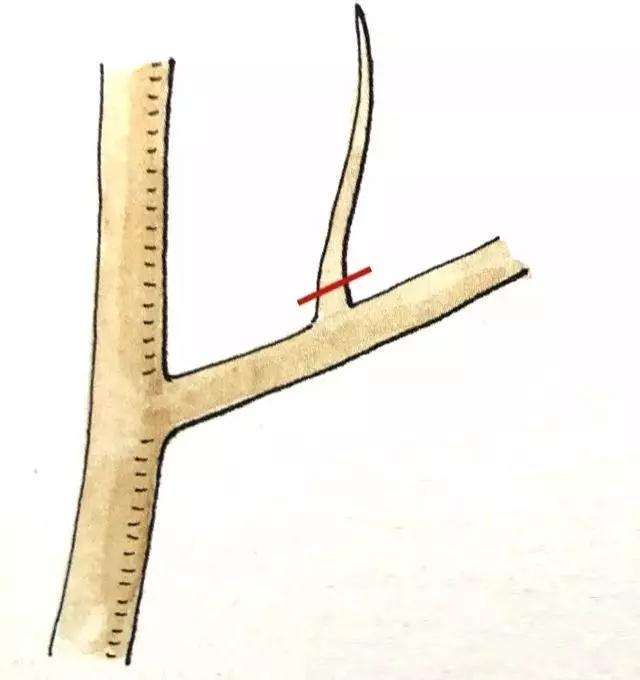 盆景定枝修剪忌枝的种类有哪些