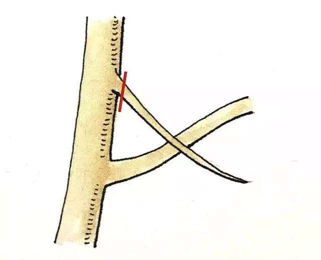 盆景定枝修剪忌枝的种类有哪些