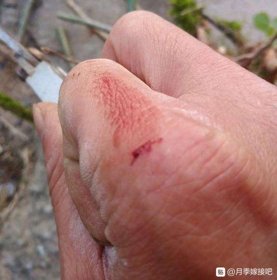 挖点蔷薇下山桩不容易