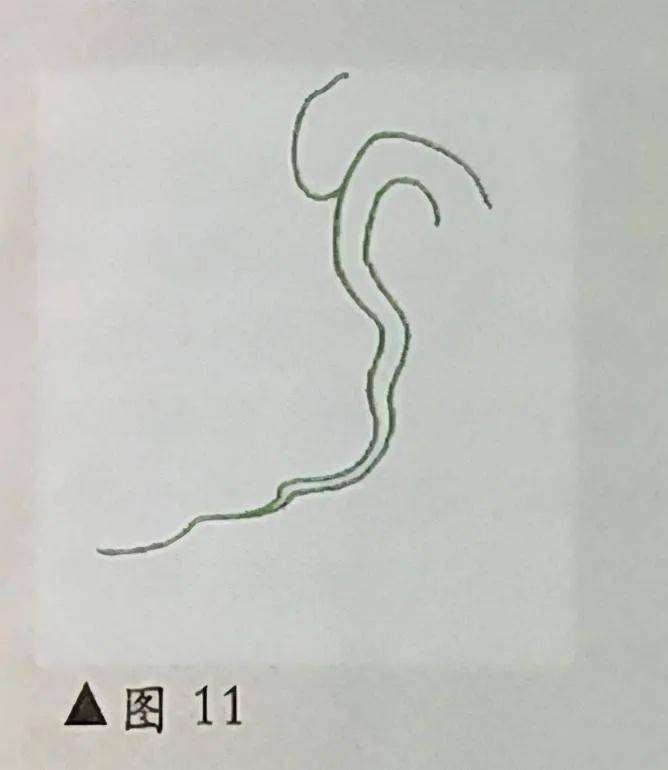 悬崖式盆景怎么顶托走向