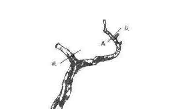 图解 怎样确定盆景的截桩高度