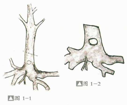 劣桩盆景怎么造型