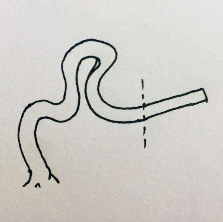 图解 盆景枝条根系为什么要舍的5个原因