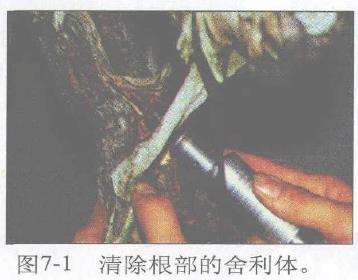 图解 赤松盆景根部怎么改造10个步骤