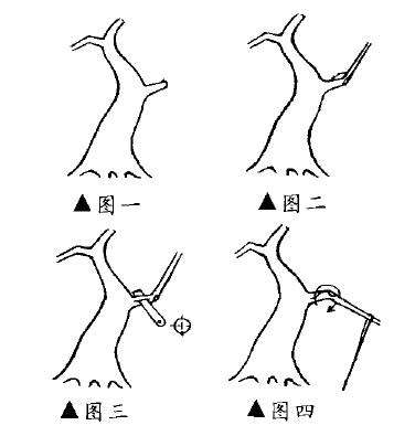 盆景造型中枝干成角的旋转法