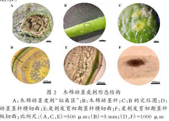 图2-A、B、C：木棉幼茎皮刺的形态结构。图A显示皮刺与茎皮连接处的“似离区”为粗糙的絮状表皮结构，暗示其没有维管束；图B显示幼茎茎秆上的未成熟皮刺为白色小点；图C是未成熟皮刺的放大图，可见突起中央变为褐色。